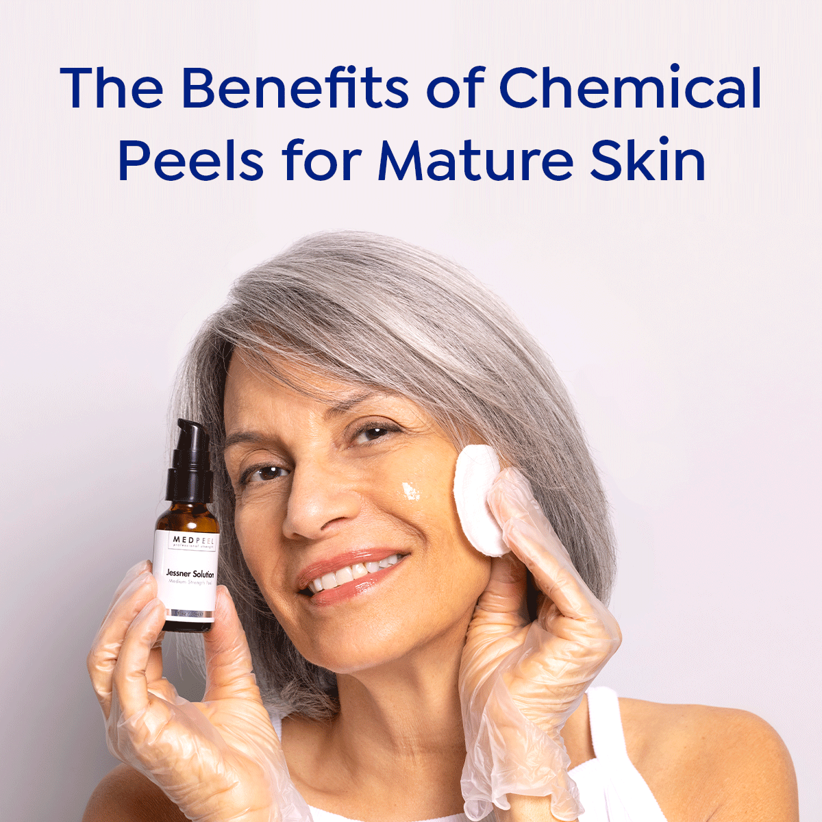 The Benefits of Chemical Peels for Mature Skin